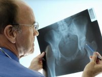 sovdok.ru: остеопороз на рентгене