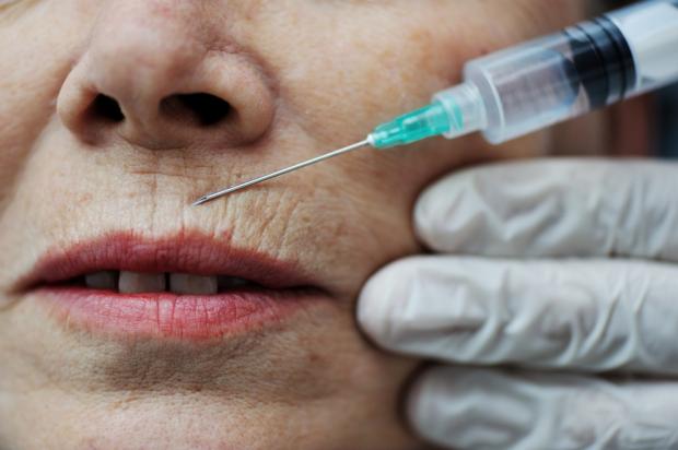 инъекции в губы против старения